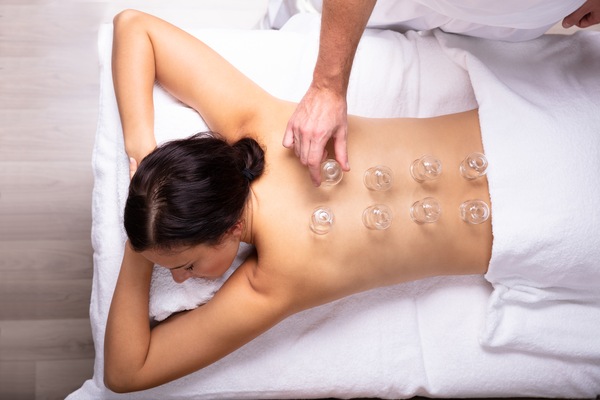 Cupping Therapy: The Dos and Don’ts After Your Session